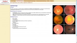 Mit Clinisurf lassen sich bestimmte Befunde aus der Augenheilkunde lernen